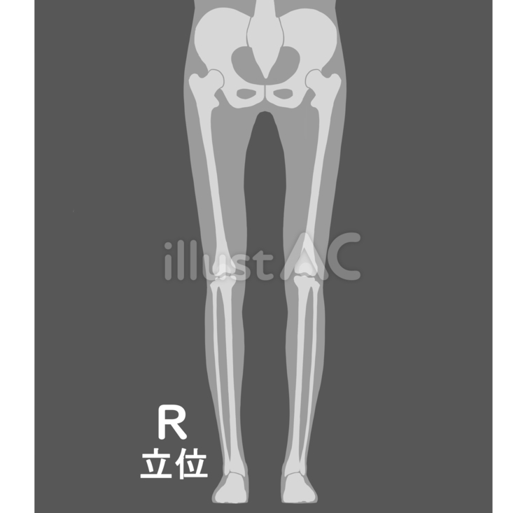 全下肢立位 医療,レントゲン,撮影のイラスト素材