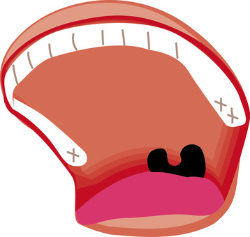 叫ぶ口　 叫ぶ,口,口内,歯,舌,のどちんこ,顔,パーツのイラスト素材