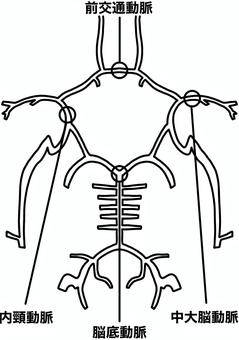 脳動脈瘤のできやすい場所　線画 脳動脈瘤,好発,血管,名称,脳底動脈,前交通動脈のイラスト素材