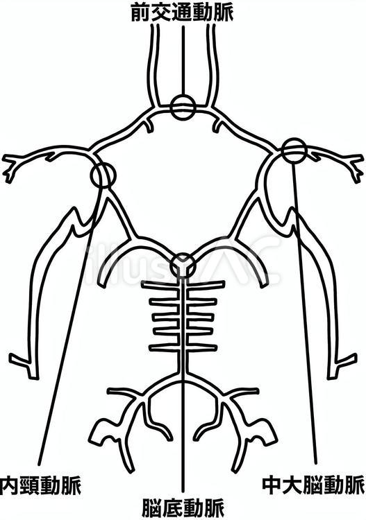 脳動脈瘤のできやすい場所　線画 脳動脈瘤,好発,血管のイラスト素材
