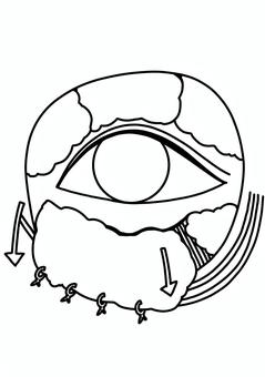 裏ハムラ法　線画 裏ハムラ,美容整形,目元,クマ取り,脂肪,線画のイラスト素材