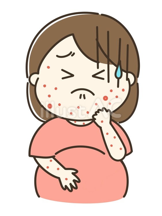 発疹が出ている妊婦の女性のイラスト 発疹,ブツブツ,水疱瘡のイラスト素材