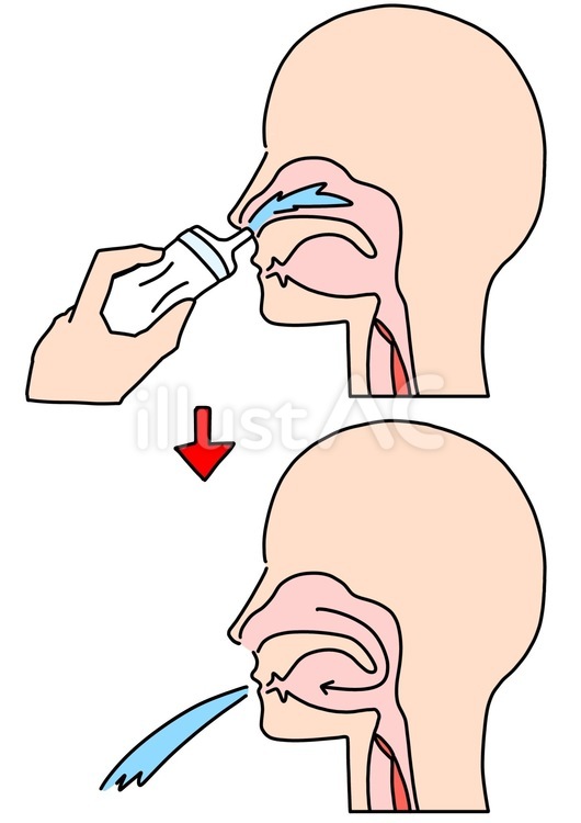 鼻うがいで口から洗浄液を出す　線　カラー 鼻うがい,鼻腔,内部のイラスト素材