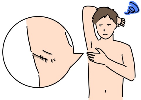 腋の傷を気にする男性　カラー 腋下,男性,コンプレックス,傷,カラーのイラスト素材