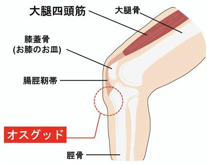 奧斯古德插圖, JPG 和 PNG 奧斯古德插圖, 大腿四頭筋, 奧斯古德, 膝蓋, JPG 和 PNG