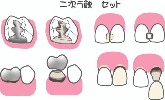 二次う蝕セット 歯科,治療,二次う蝕,むし歯,インレー,レジン充填,fmc,前装冠,前歯,奥歯のイラスト素材