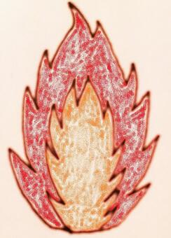 inflammation, JPG inflammation, , JPG