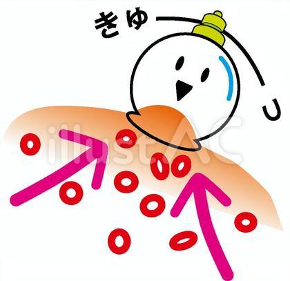 吸角・吸い玉・カッピング
