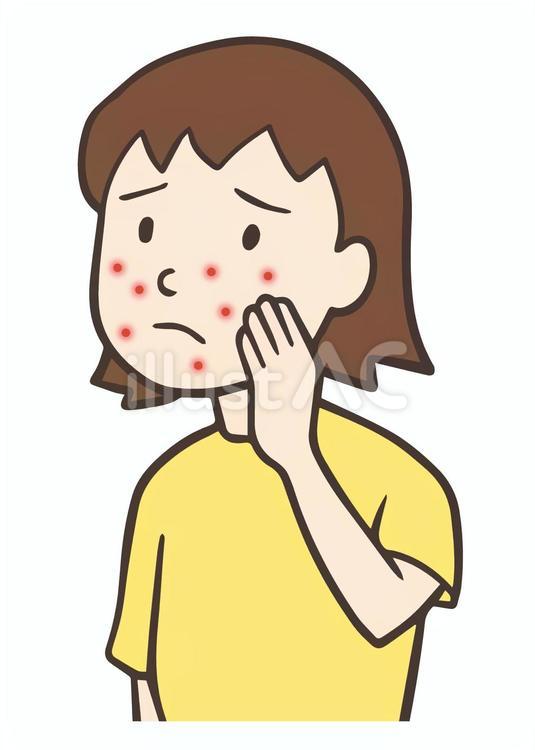 アトピー、肌荒れが気になる女性 アトピー,湿疹,アトピー性皮膚炎のイラスト素材