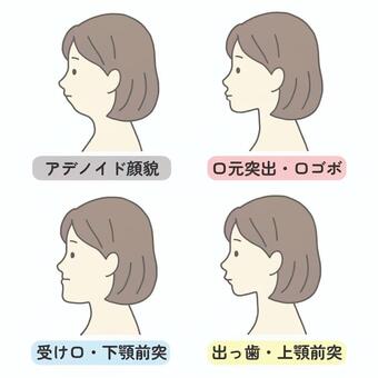 色々な横顔 アデノイド,女性,顎,横顔,アデノイド顔貌,人物,白背景,手描き,イラスト,挿絵のイラスト素材