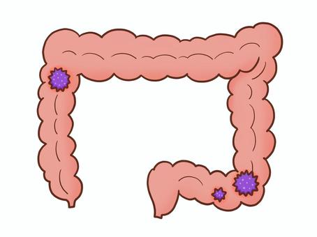 大腸がんの大腸(シンプル) 大腸,内臓,臓器,腸,腸活,腸内,医療,手がき,シンプル,フリーハンドのイラスト素材