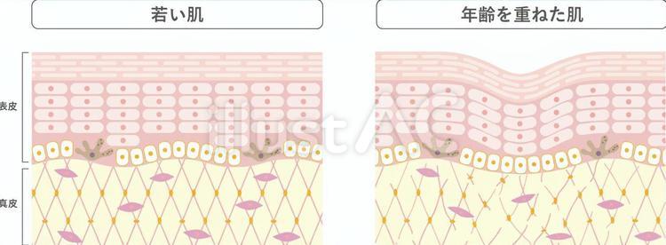 若い肌と年齢を重ねた肌 皮膚,表皮,真皮のイラスト素材