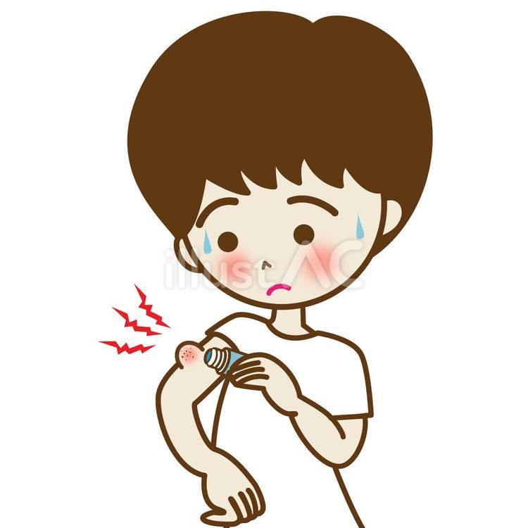 虫に刺されて薬を塗ってる男の子 虫刺され,腫れ,かゆいのイラスト素材