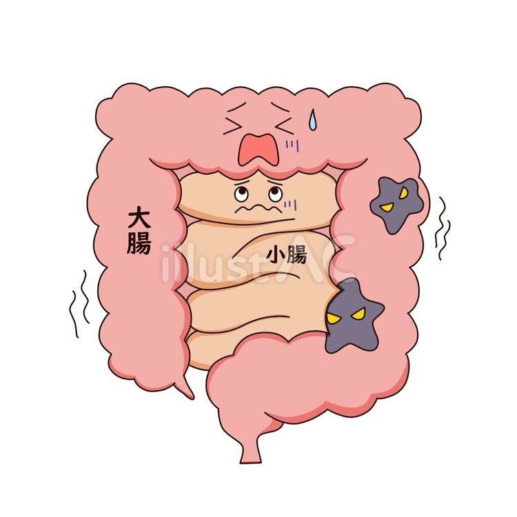 病気になった大腸 大腸,腸,病気のイラスト素材