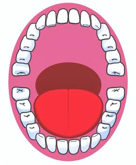 Dentition / mouth, tooth alignment, oral, tooth, JPG and PNG