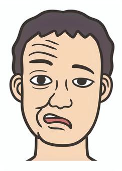 麻痺の症状、男性の顔１ 顔面神経麻痺,ベル麻痺,ベル現象,顔面,神経,麻痺,表情筋,神経障害,片側麻痺,閉眼障害のイラスト素材