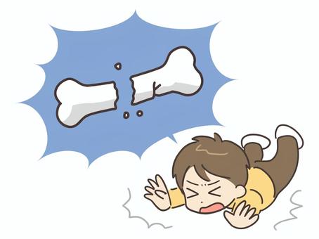 転倒して骨折する男性 骨折,転倒,男性,怪我,転ぶ,こける,骨,折れる,骨粗鬆症,骨粗しょう症のイラスト素材