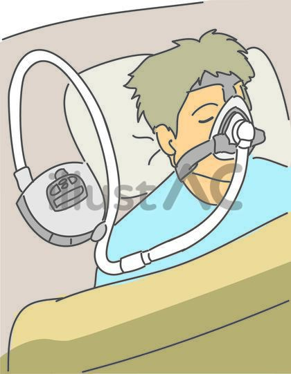 睡眠時無呼吸症候群の治療