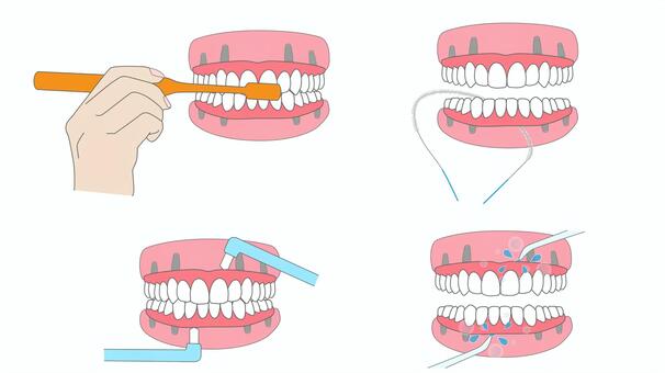 オールオン４_清掃方法 歯科,歯科治療,オールオン４,インプラント,歯ブラシ,歯みがき,手,フロス,スーパーフロス,タフトブラシのイラスト素材