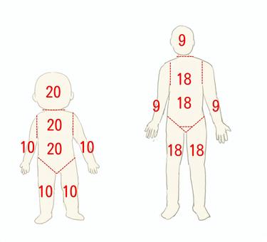 5の法則 9の法則 やけど