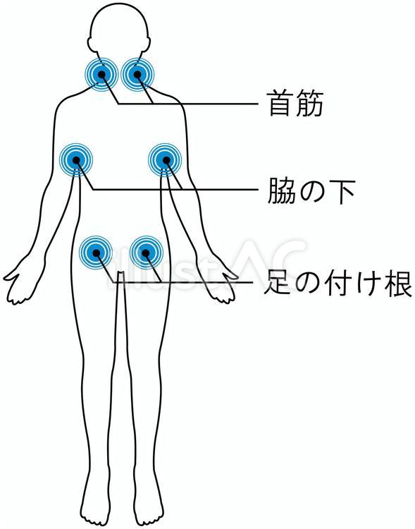 熱中症対策　冷やすポイン２ト文字あり 熱中症,応急処置,緊急処置のイラスト素材