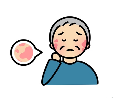 帯状疱疹になるおじいちゃん おじいちゃん,祖父,男性,帯状疱疹,肌荒れ,赤み,肌トラブル,病気,皮膚,痒いのイラスト素材
