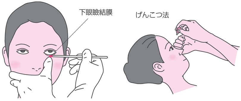 下眼瞼結膜と点眼 目,下眼瞼結膜,点眼薬,点眼,げんこつ法,図解,説明,セット,人体,人物のイラスト素材
