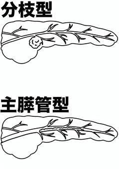 IPMN2種 線画 IPMN2種 線画 膵臓,嚢胞,種類,分枝型,主膵管,病気,線画のイラスト素材