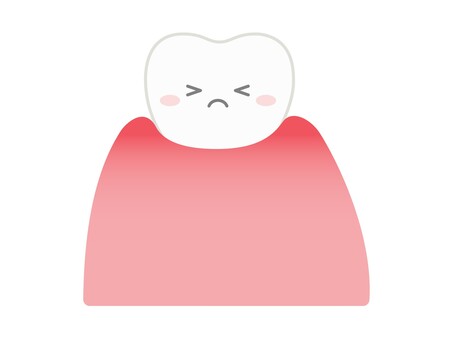 軽度の歯肉炎の歯　顔付き 歯,歯周炎,軽度,腫れ,炎症,顔,顔あり,歯科,説明,歯ぐきのイラスト素材