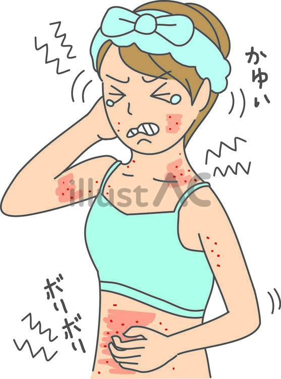 お風呂上りに痒くて お風呂上りに痒くて 女性,お風呂,シャワーのイラスト素材