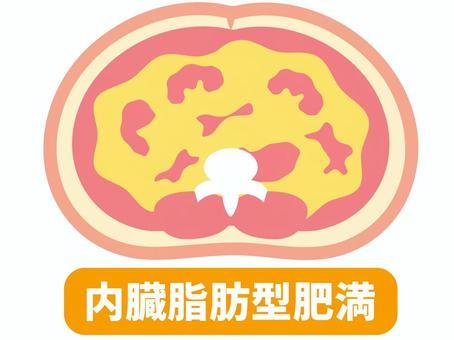 内蔵型肥満の図解 内臓脂肪型肥満,人体,図解,皮下脂肪,内臓脂肪,肥満,脂肪,腹部,お腹,輪切りのイラスト素材