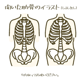 開いた肋骨のイラスト　リブフレア 肋骨,リブフレア,姿勢,健康,美容,鍼灸院,接骨院,骨格矯正,骨盤矯正,姿勢改善のイラスト素材