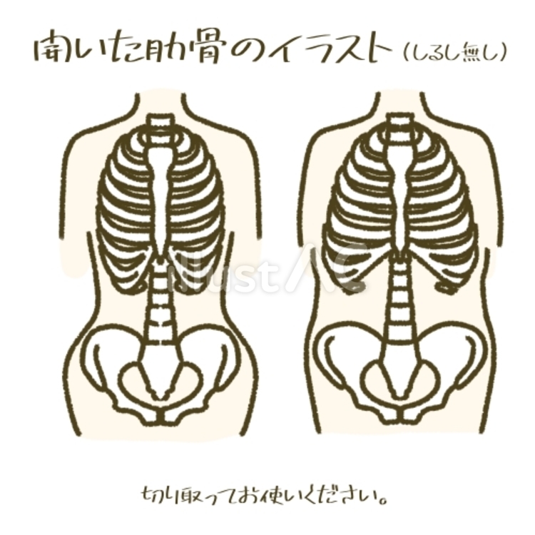 開いた肋骨のイラスト　リブフレア 肋骨,リブフレア,姿勢のイラスト素材
