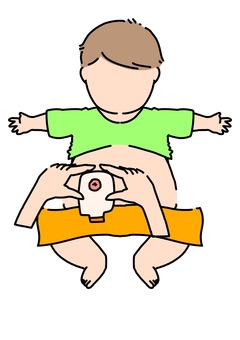 ストマパウチ交換する乳児正面　カラー ストマ,パウチ,オストメイト,赤ちゃん,交換,カラーのイラスト素材