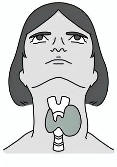 片側甲状腺の腫れた女性　白黒 片側,甲状腺,腫脹,腫瘍,女性,白黒のイラスト素材