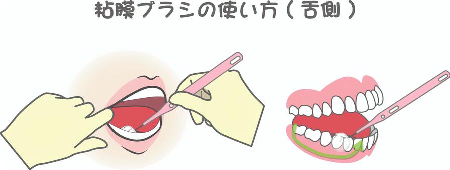 Illustration, oral care, dentistry, mucosa, 