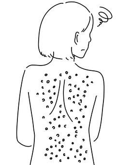 背中にぶつぶつ　女性線画 背中,女性,皮膚,異常,肌荒れ,コンプレックス,トラブル,線画のイラスト素材