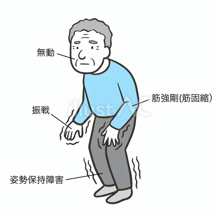症状が現れている男性2 パーキンソン病,パーキンソン,症状のイラスト素材
