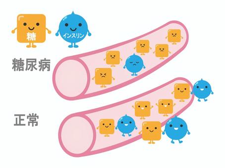 糖尿病2 糖尿病,血管,正常,糖,インスリン,医療,笑顔,キャラクター,かわいい,イラストのイラスト素材