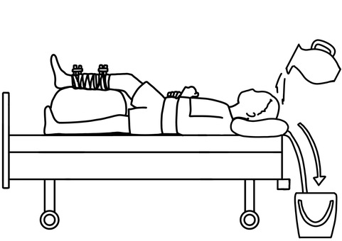 創外固定中の患者のベッド上洗髪 線画 創外固定中の患者のベッド上洗髪 線画 創外固定,整形外科,治療中,洗髪,ベッド,清潔,安静,線画のイラスト素材