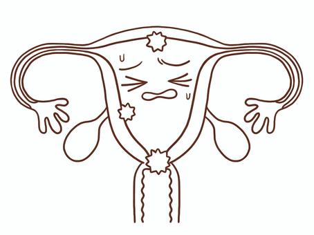 子宮癌の子宮(色なし) 子宮,卵巣,卵管,臓器,内臓,膣,手がき,フリーハンド,白背景,背景透過のイラスト素材