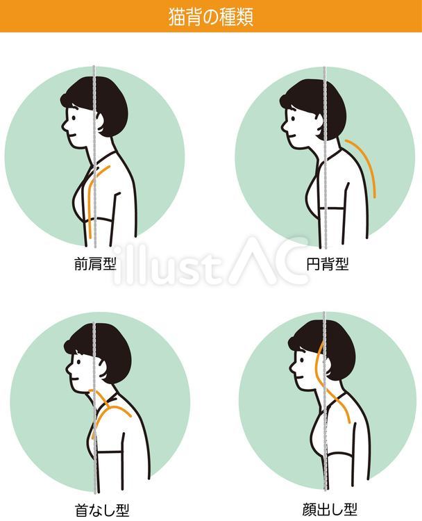 猫背の種類 猫背,姿勢,整体のイラスト素材