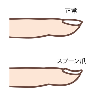 Illustration, claw, normal, spoon claw, 