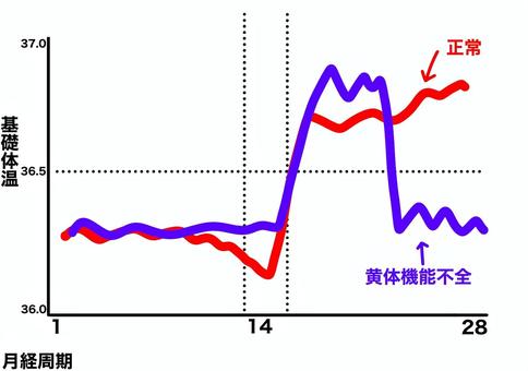 黄体機能不全と正常の基礎体温グラフ 黄体機能不全,正常,基礎体温,グラフ,月経周期,高温期のイラスト素材