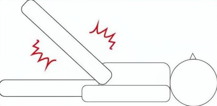 ヘルニアの疑いがある人 ヘルニア,怪我,痺れ,リハビリ,整形外科,医療,治療,ストレッチ,検査,理学療法のイラスト素材