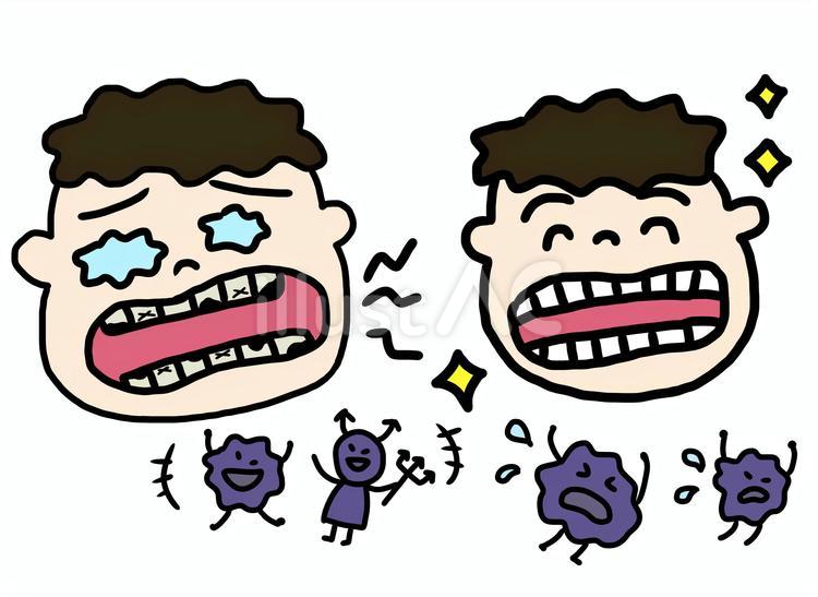 虫歯と綺麗な男の子 男の子,虫歯,歯のイラスト素材