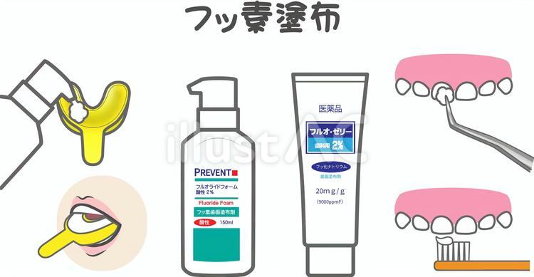 フッ素塗布 歯科,フッ素塗布,高濃度のイラスト素材