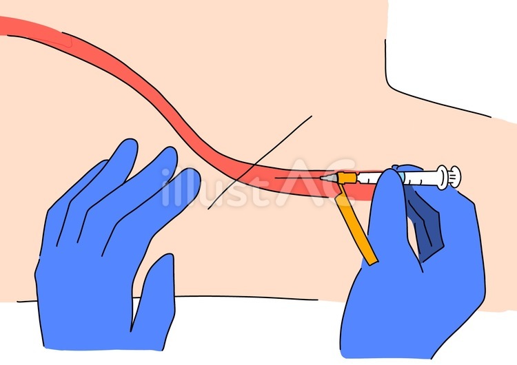 動脈採血イメージ　カラー 動脈,採血,血管のイラスト素材