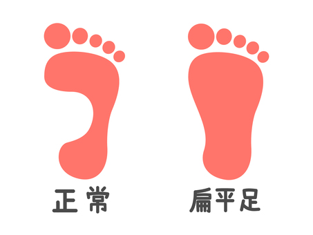 足跡セット(正常と扁平足) 足跡,足,足底,人物,土踏まず,扁平足,ヘルスケア,シンプル,デフォルメ,セットのイラスト素材