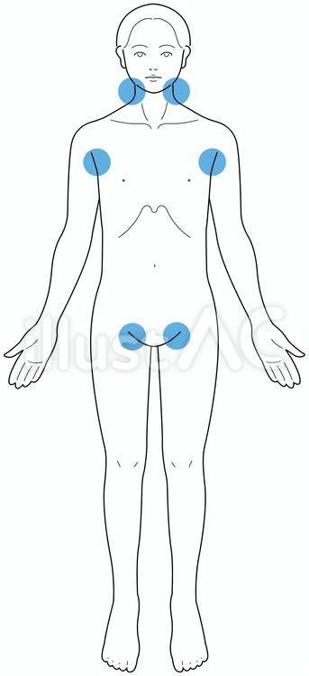熱中症対策　冷やすポイント 熱中症,応急処置,緊急処置のイラスト素材